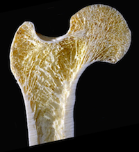 Cross-section of the proximal end of a human femur